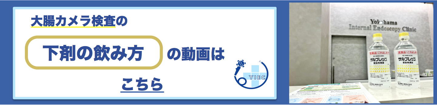 大腸カメラ検査での下剤の飲み方
